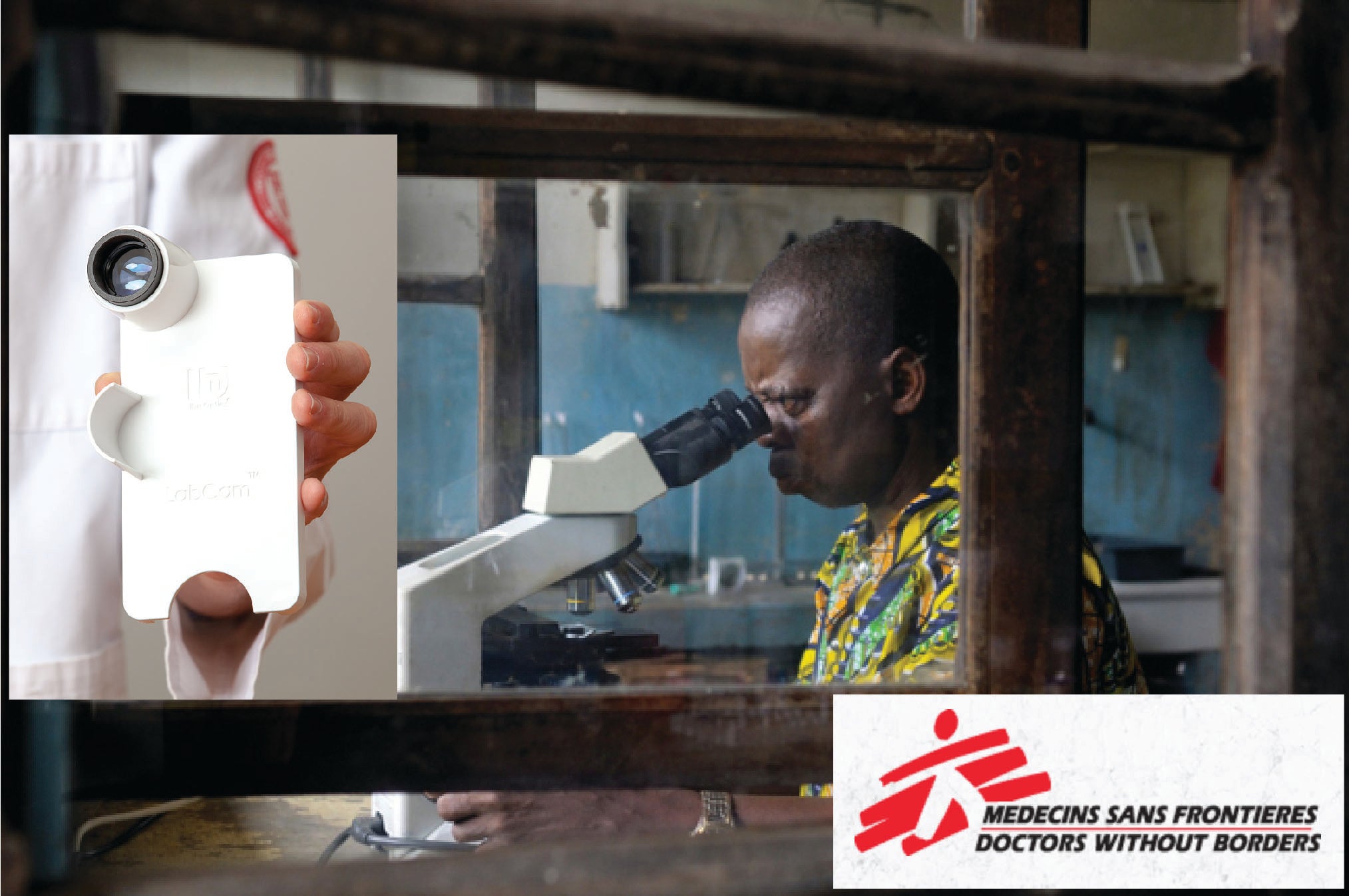 Doctors Without Borders finds best results with LabCam over two microscope adapters