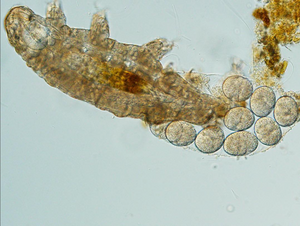 Researcher captured a water bear tardigrade laying eggs with LabCam