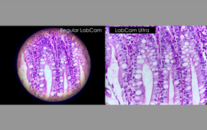 LabCam Ultra® for iPhone (Pathology, high-end Microscopes, Telescopes & Slit Lamps)